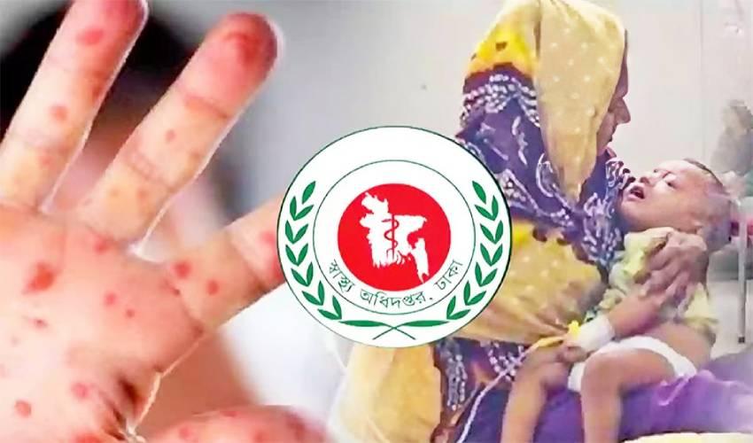 ২৪ ঘণ্টায় হামের উপসর্গে আরও ৩ শিশুর মৃত্যু